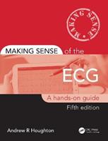 Making Sense of the ECG: A Hands-On Guide